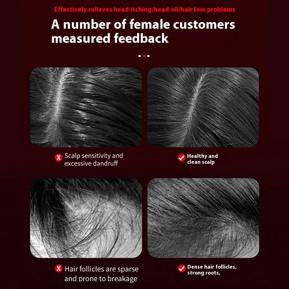 Electric Vibration Massage Comb Blue Red Light Therapy Hair Growth Massage Scalp Brush Anti Hair Loss Improve Scalp Health Care