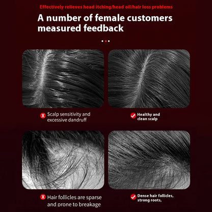 Electric Vibration Massage Comb Blue Red Light Therapy Hair Growth Massage Scalp Brush Anti Hair Loss Improve Scalp Health Care