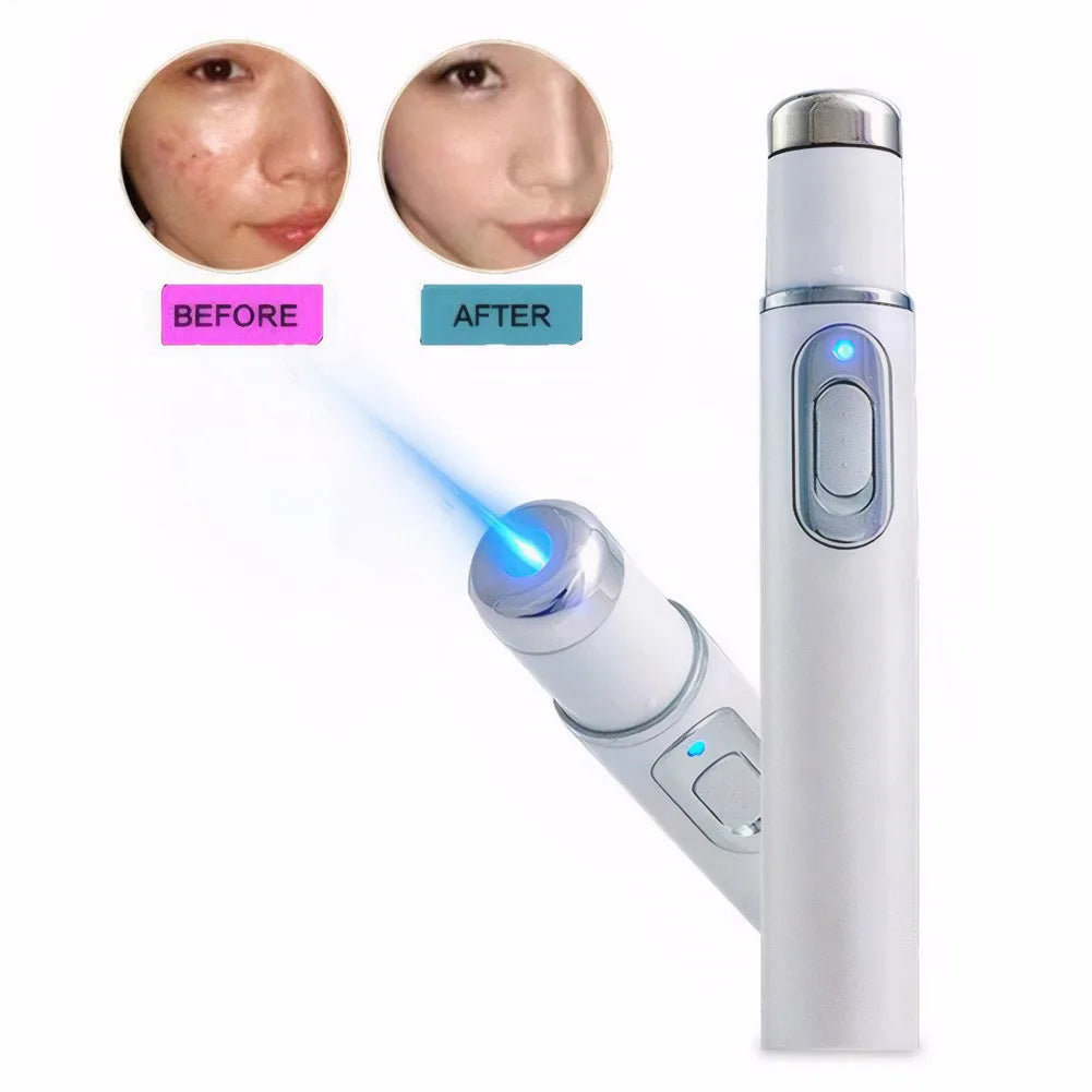Blue Light Therapy Acne Pen Heated Eye Beauty Device Eye Massage Instrument for Dark Circles Eye Bags Puffiness Under Eyes