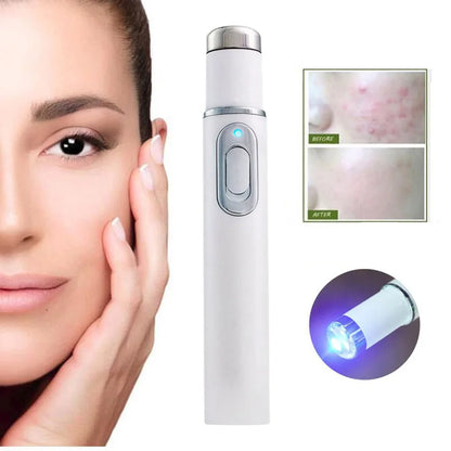 Blue Light Therapy Acne Pen Heated Eye Beauty Device Eye Massage Instrument for Dark Circles Eye Bags Puffiness Under Eyes